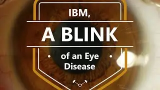 #101 IB Myositis IBM, A Blink Of An Eye Disease