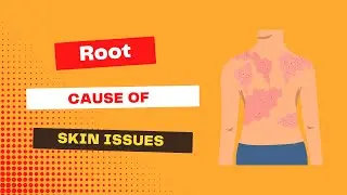 Skin Issues