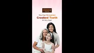 Crooked Teeth  | Clove Dental