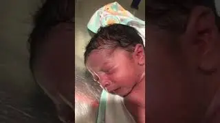 Now The Time Of Dressing for Baby ,Vernix Cleaning Done Previous 1 Minute