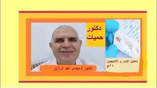 тест на ВИЧ