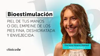 CAP 11 I Bioestimulaci&oacute;n.Piel de tus manos o del empeine de los pies fina, deshidratada envejecida.