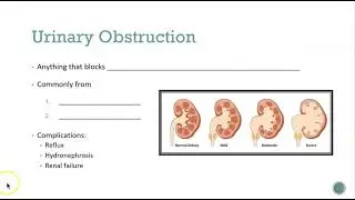 Other Urinary Problems