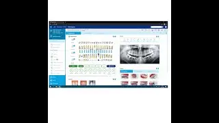 Vídeo Resumen del Software de Gestión Clínica GESDEN EXPRESS de Infomed