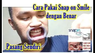 Snap On Smile how to use Snap On Smile dental veneers correctly / How to Use Snap on Smile