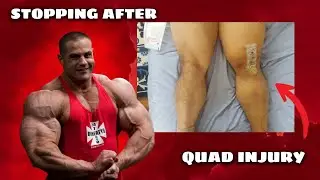 The Bodybuilding TRAP: When Injuries Force You to Quit The Stage