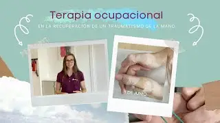 Terapia ocupacional en la rehabilitación de un traumatismo de la mano