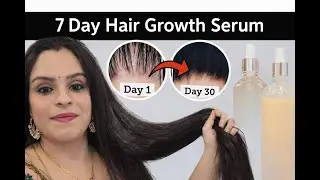 Day 7: Stop Hair Fall & Frizz Fast! Homemade Magic Serum for Silky Hair