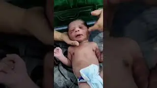 NICU abusing newborn 😡 #newbornbaby #nicu