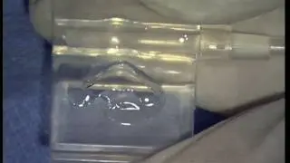 ND Ring : Loading technique