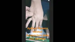 Release Pain in 2 minutes on Shoulder & Hand. #BalanceMethod Acupuncture123