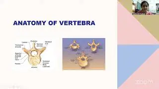 Anaesthesia Considerations for Spine Surgery
