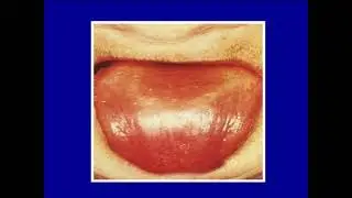 Spring 2020 ; Oral medicine 2 ; Online Lec 2 ; Red blood cell (2a,2b)