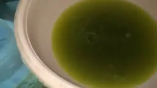 استخراج الذهب والمعادن الاخرى من السنون المطلية بطريقة الصهر المباشر (الجزء الثاني)