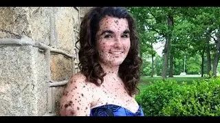 What are Birthmarks and Different Kinds of birthmarks
