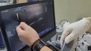 Used Alpinion E cube 9 with Convex and Linear Ultrasound