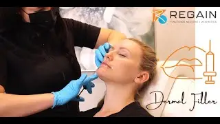 Dermal Fillers near Kansas City - Regain Functional Medicine + Aesthetics