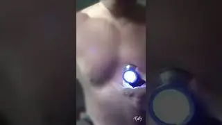 Auscultation stethoscope heart sounds fast heartbeat after fitness