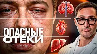 Отёки: когда это почки, сердце, печень и как их отличить