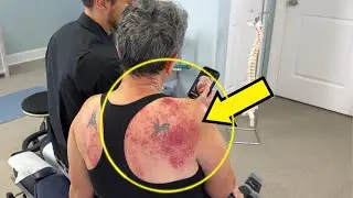 *FIRST Crack* Of Her Life - Shocking Amount Of GUNK Pours From Shoulder 😳 Unintentional ASMR