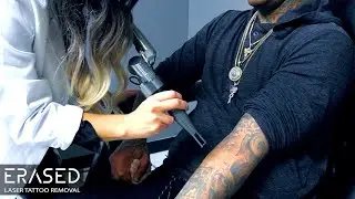 How to Remove a Tattoo - In Only 90 Minutes
