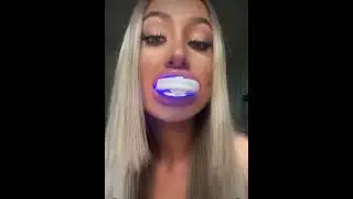 Advanced Led Whitening Kit