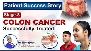Stage 3 colon cancer-Happy patient- colon cancer! स्टेज 3 colon cancer का  सफल इलाज! 