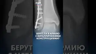 Берут ли в армию с металлическими конструкциями?