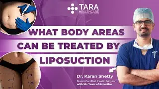 What Body Areas Can Be Treated by Liposuction?