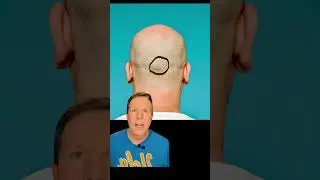 Наружный затылочный выступ #каналсанатомиидреллеров