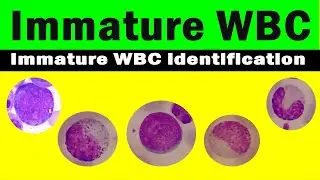 How to differentiate immature WBC | immature WBC identification | Hematology