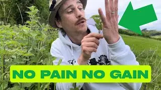 Stinging Nettle stings are GOOD for us! 