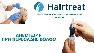 Обезболивание (анестезия) при пересадке волос