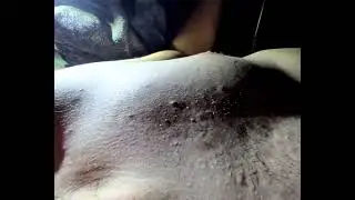 Visible heartbeat with neck pulse.