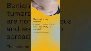 Kidney Tumors Explained in 60 Seconds#KidneyTumor  #MBBS #MedicalShorts  #MedEd #ClinicalClassroom