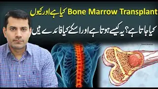 Understanding of Bone Marrow Transplant | Bone Marrow Transplant kaise Hota Hy? | Dr Nasir Abbas