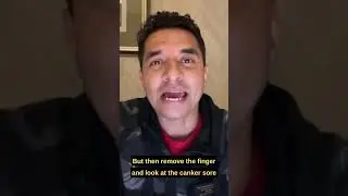 A Simple Inexpensive & Effective Remedy For Canker Sores