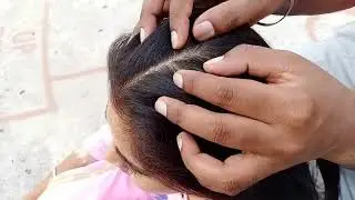Mannu Long Hair Nit Picking By Male Full Video Available Now In Membership