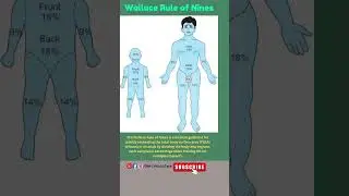 Wallace Rule of Nines|TBSA|Burns Area Calculation #tbsa #burn #ytshorts #shorts