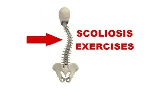 Atlanta Chiropractor - Scoliosis Exercises and Stretches - Car Accident Doctor Atlanta