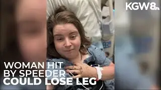 Vancouver woman may lose a leg after being hit by speeding driver, family says