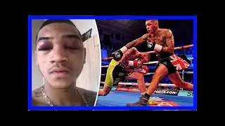 Boxer conor benn reveals gruesome injuries after gutsy win over cedrick peynaud