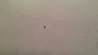 Watch Live Lice on a Pillowcase! | How Long Can Lice Live Off the Head?