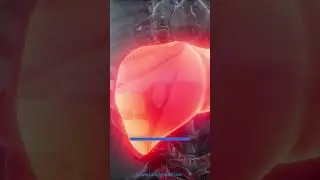 World Liver Day