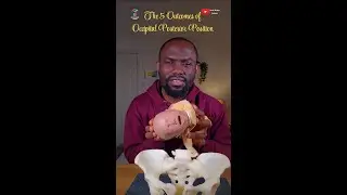 The 5 Outcomes of Occipital Posterior Position OPP - Back to Back Labour