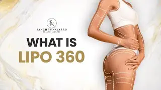 What Is Lipo 360? | Full Body Contouring Explained by Plastic Surgeon