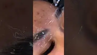 Browlift ganz einfach gemacht!