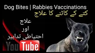 Dog Bites Prevention & Treatment| rabbies vaccine| کتے کے کاٹنے کا علاج