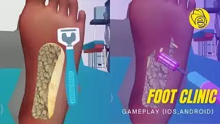 Foot Clinic All Levels Gameplay Android,ios (part 1)