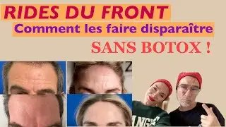 EFFACER LES RIDES DU FRONT SANS BOTOX : ON A TEST&Eacute; !